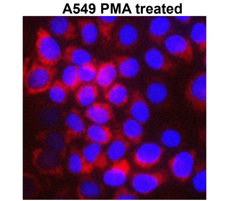 MMP1 Antibody