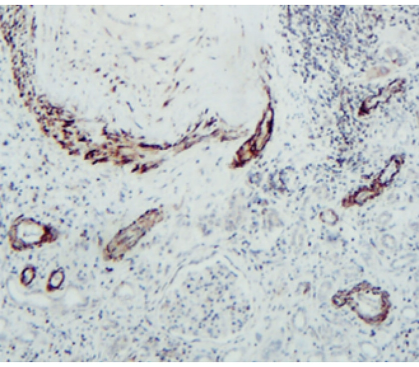 MMP1 Antibody