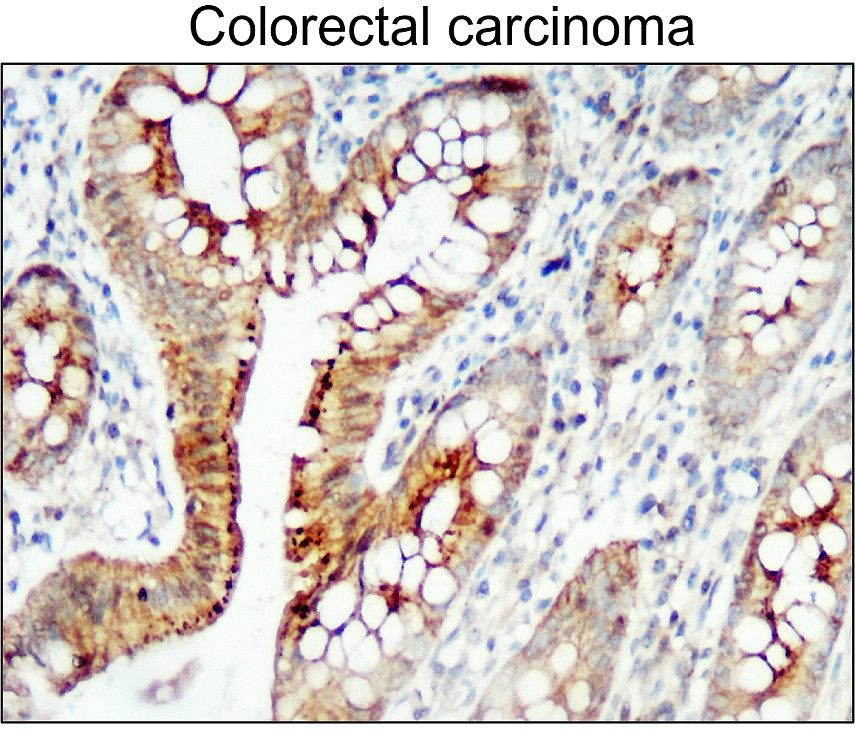 ZO-1/TJP1 Antibody