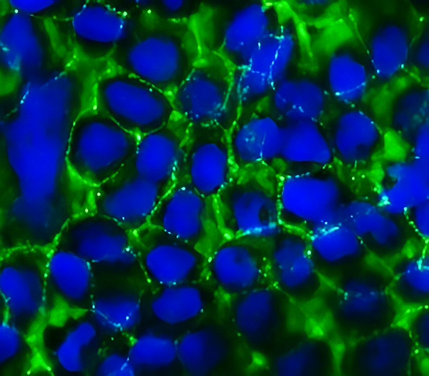 ZO-1/TJP1 Antibody