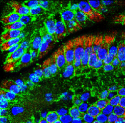 E-cadherin (Intracellular)