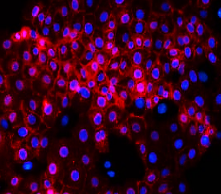 E-cadherin (Intracellular)