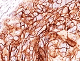 E-cadherin (Intracellular)