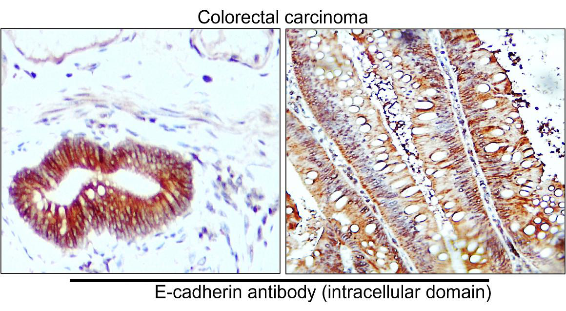 E-cadherin (Intracellular domain) antibody