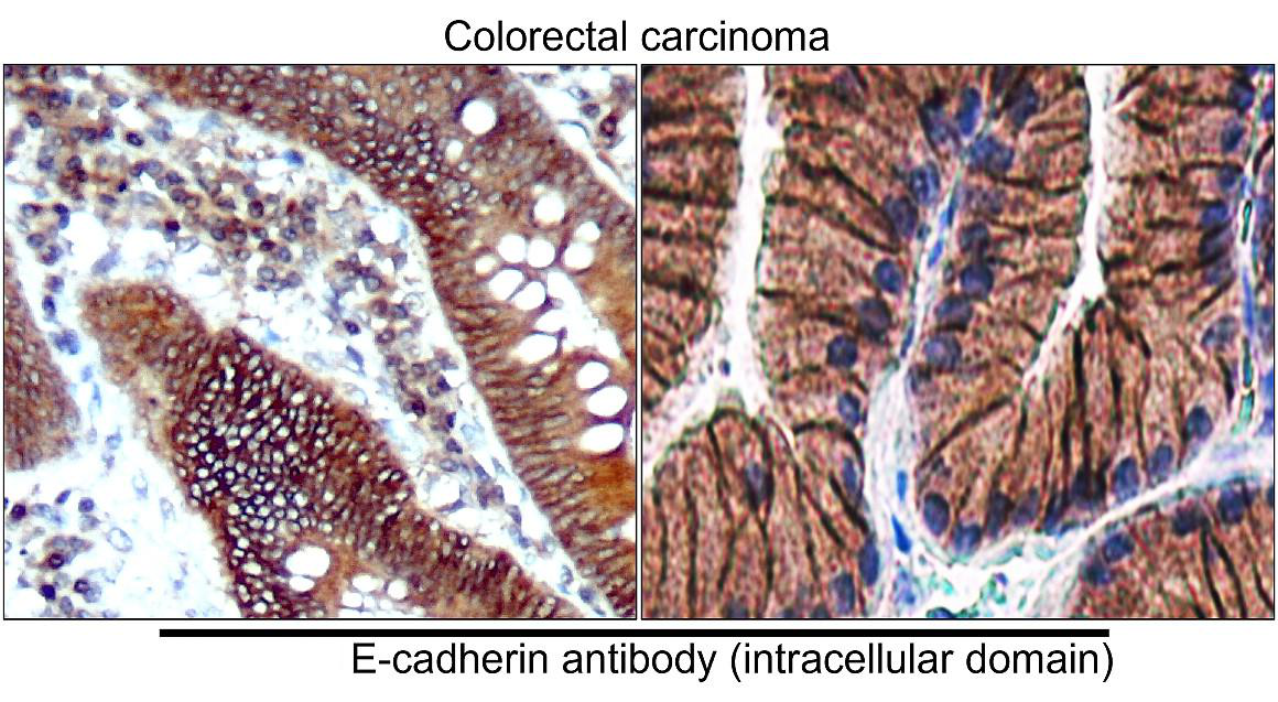 E-cadherin (Intracellular domain) antibody