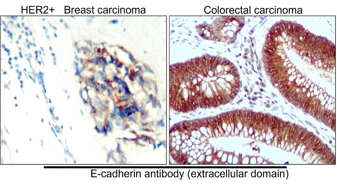 E-cadherin (Extracellular domain) antibody