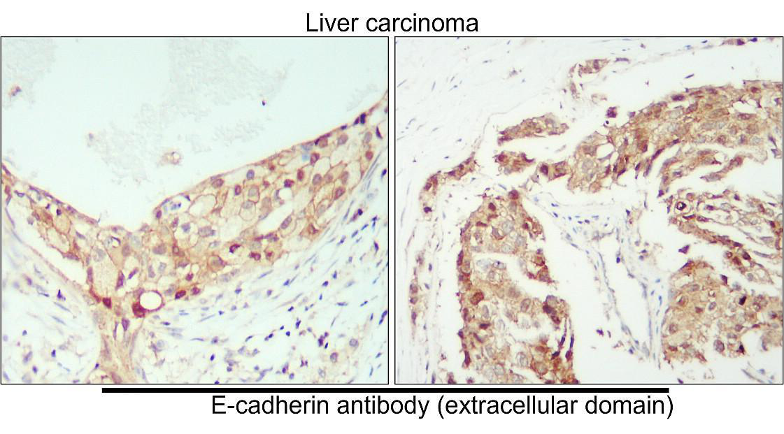 E-cadherin (Extracellular domain) antibody