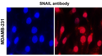 SNAIL Rabbit Polyclonal Antibody