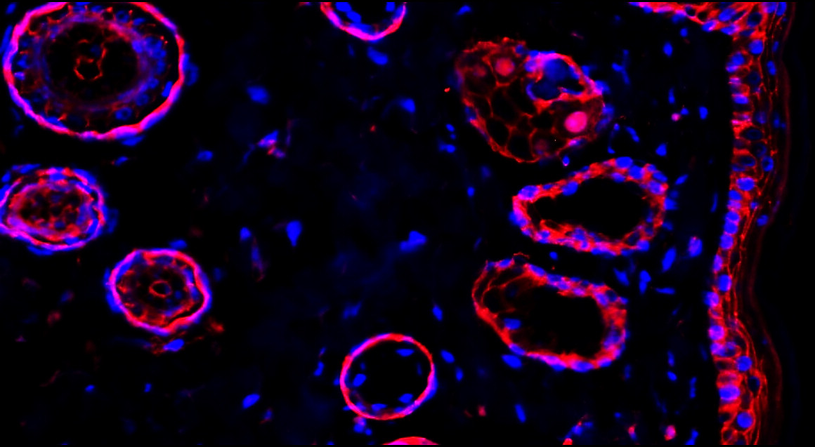 Beta-catenin Antibody