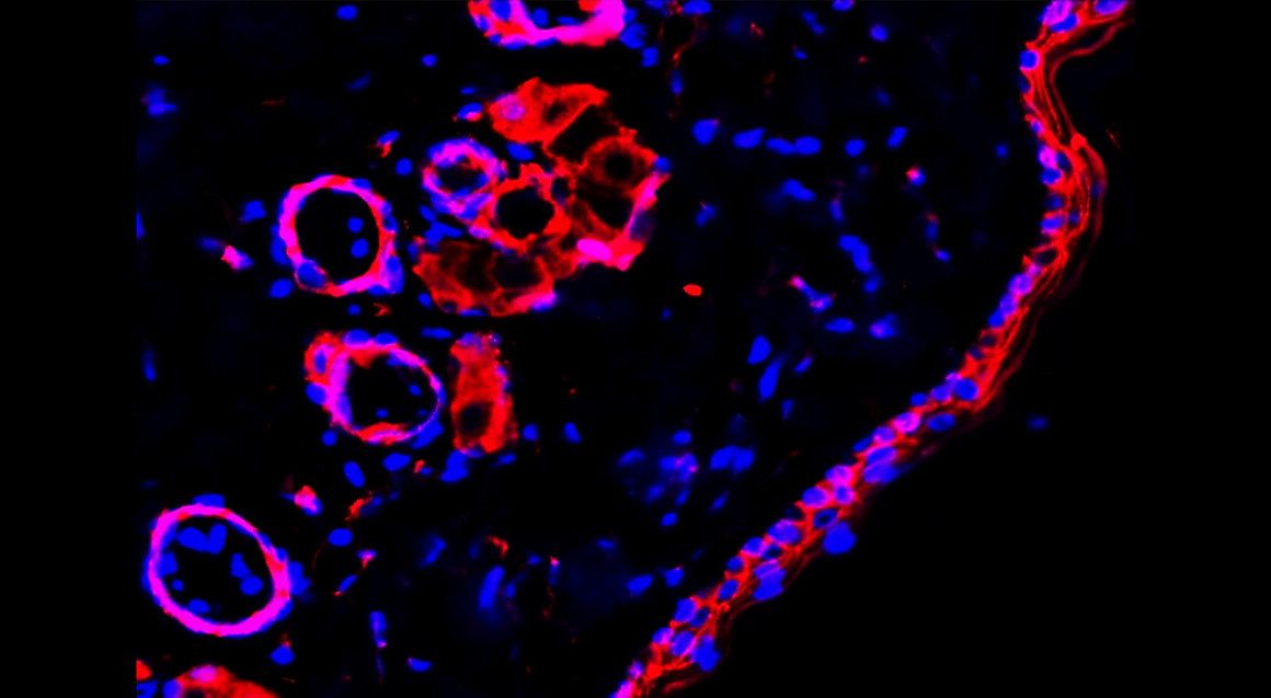 Beta-catenin Antibody