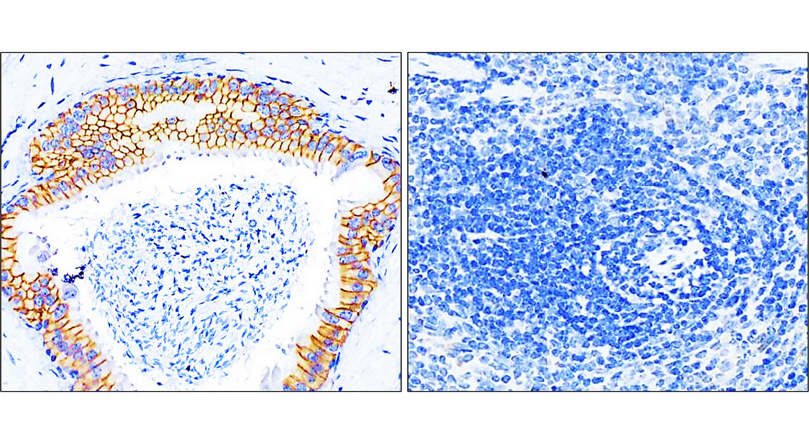 Beta-catenin Antibody