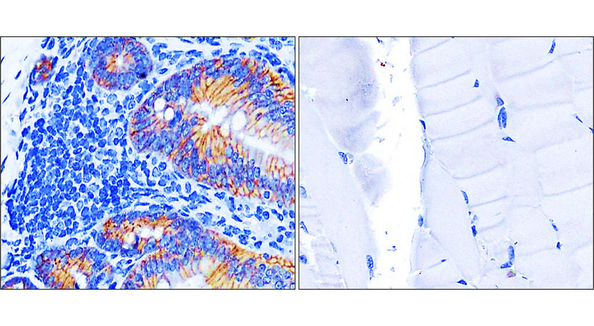 Beta-catenin Antibody