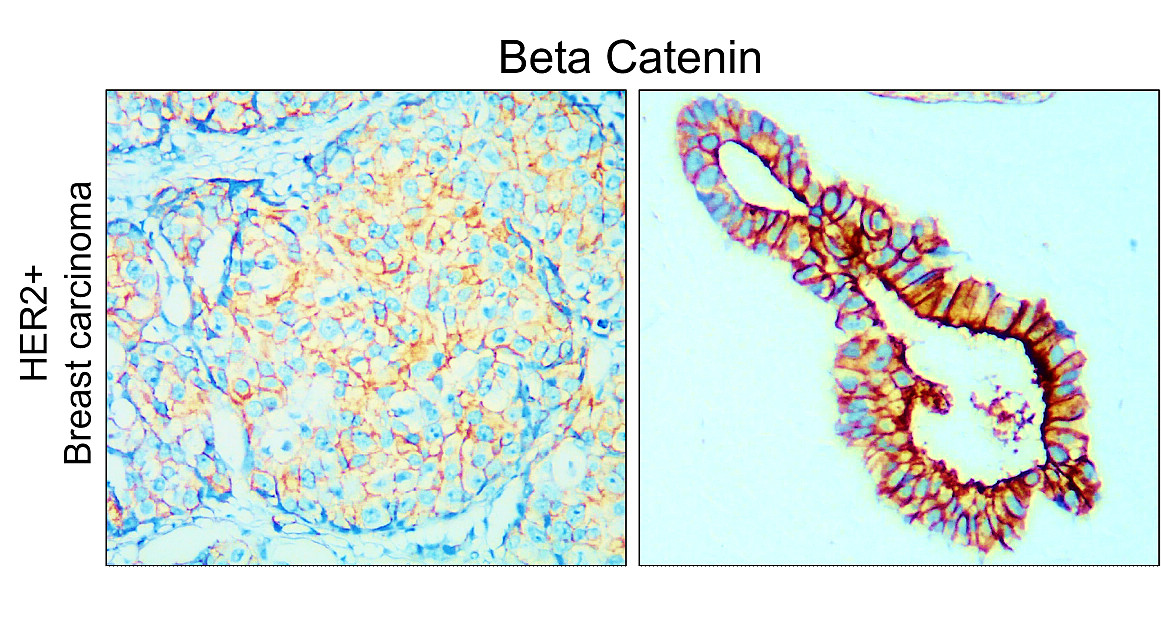 Beta-catenin Antibody