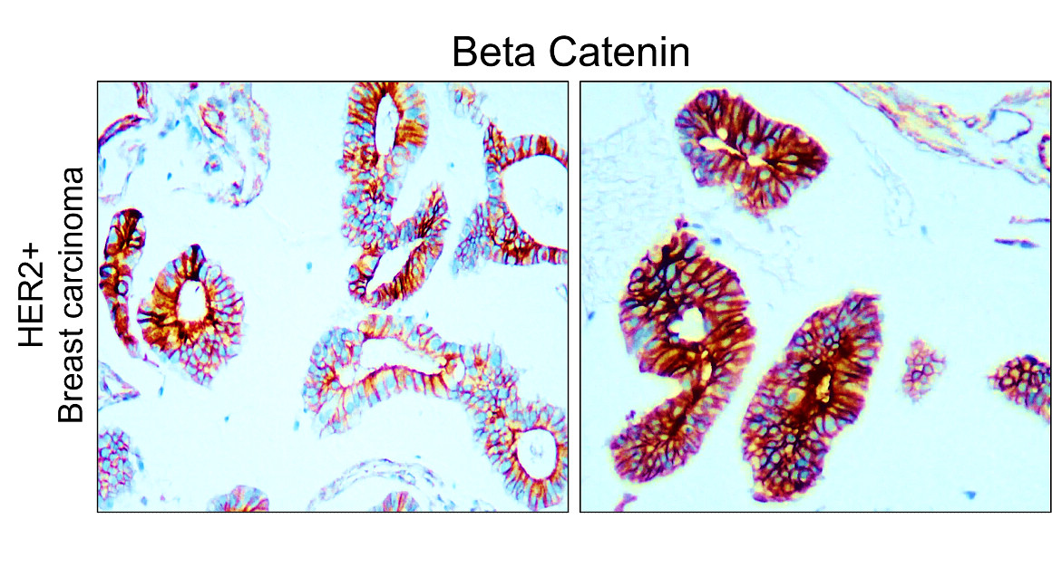 Beta-catenin Antibody