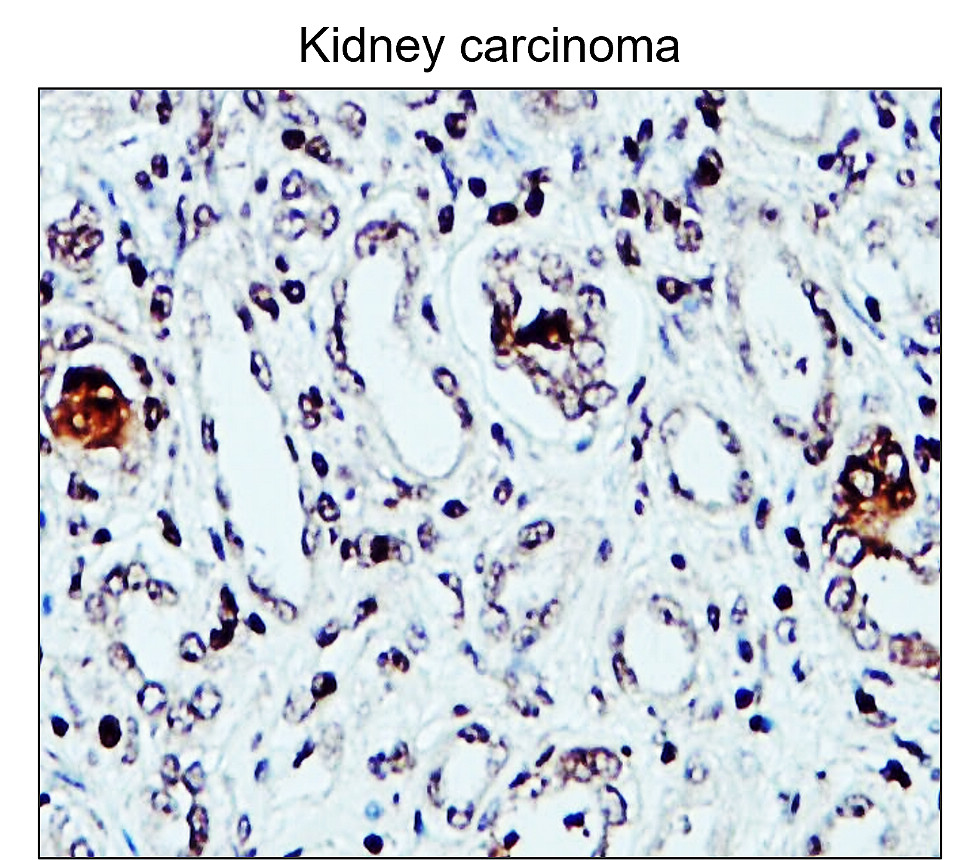 Fibronectin 1/FN1 (N-term) Antibody