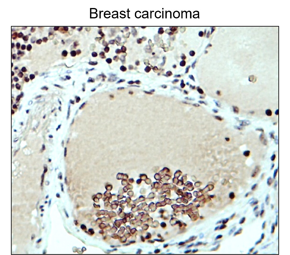 Fibronectin 1/FN1 (N-term) Antibody