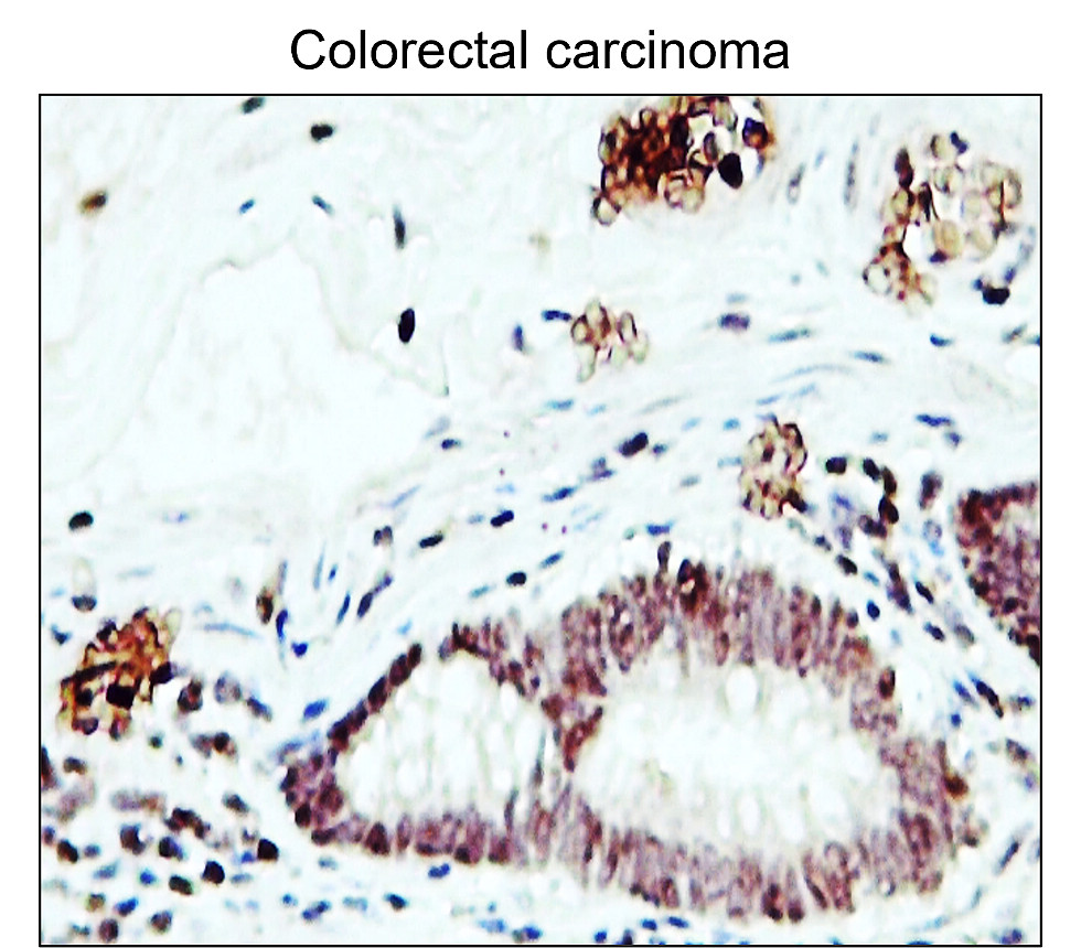 Fibronectin 1/FN1 (N-term) Antibody