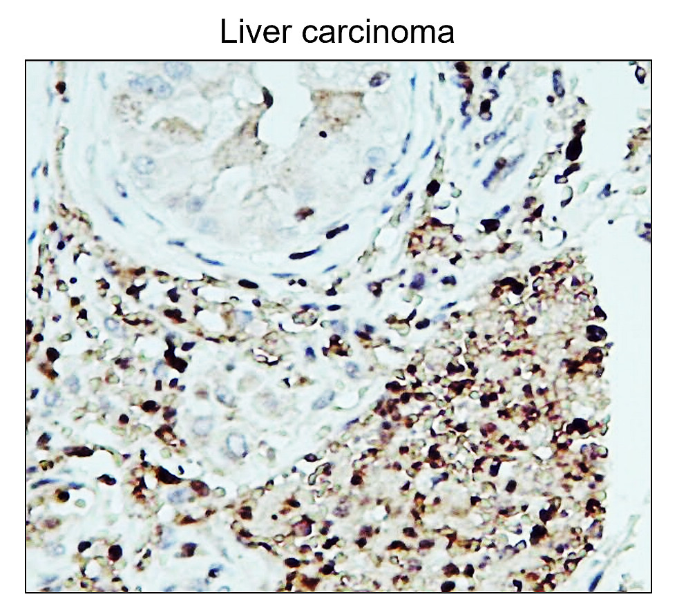 Fibronectin 1/FN1 (N-term) Antibody