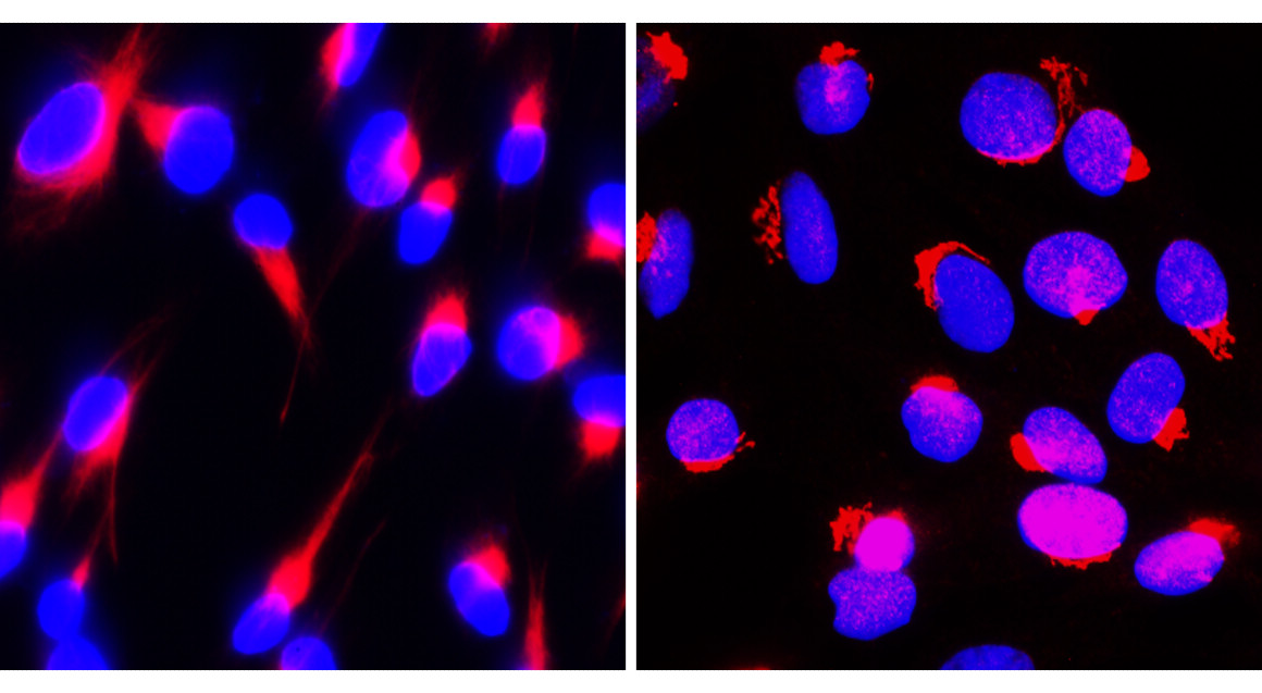 Fibronectin 1/FN1 (N-term) Antibody