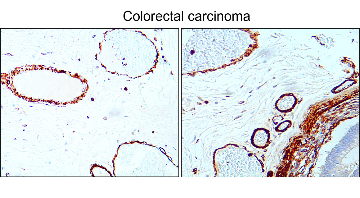 α-Smooth Muscle Actin Antibody