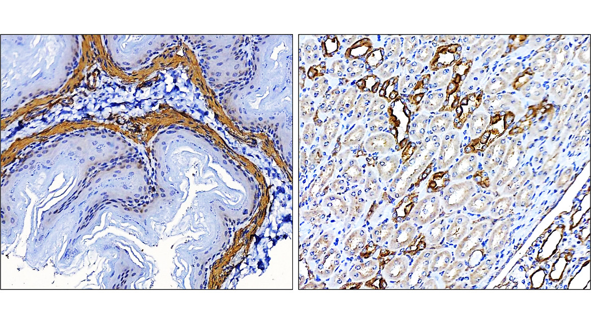 α-Smooth Muscle Actin