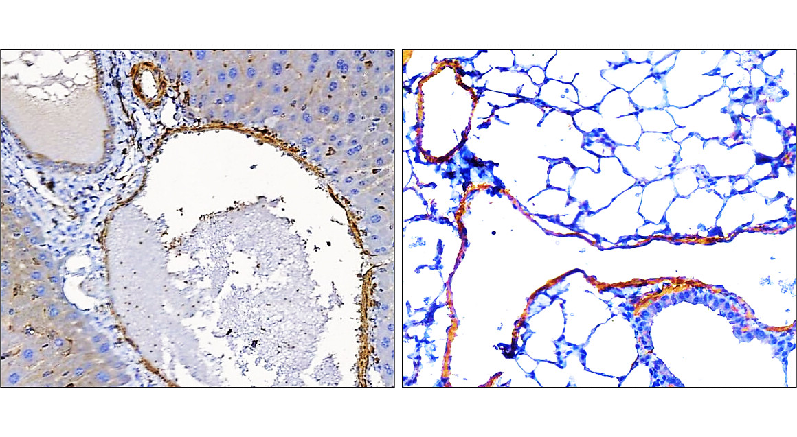 α-Smooth Muscle Actin
