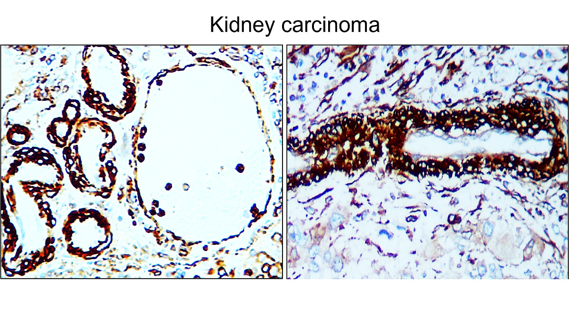 α-Smooth Muscle Actin Antibody