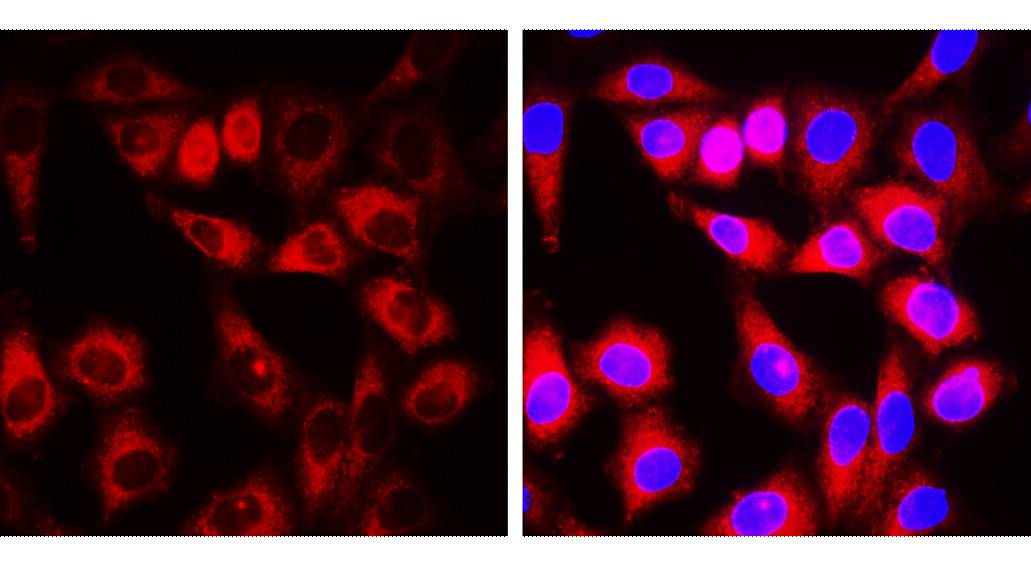 α-Smooth Muscle Actin Antibody