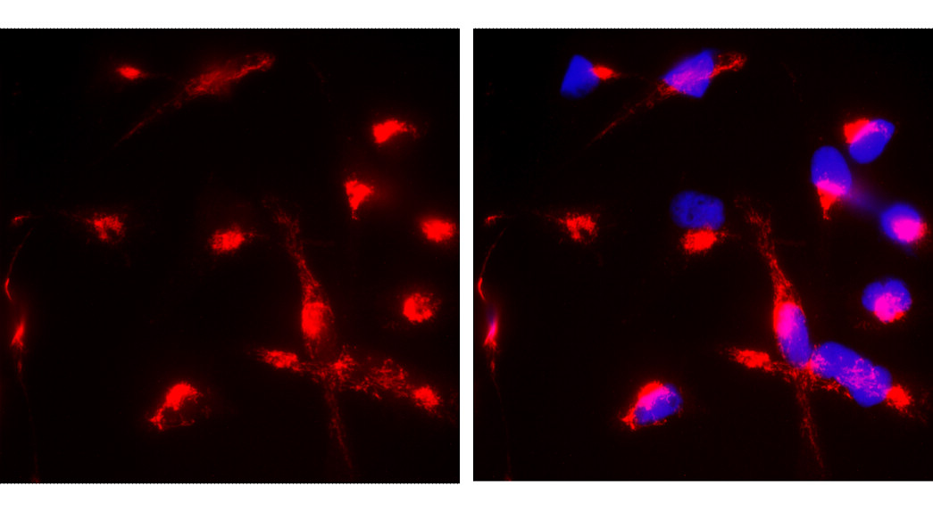 α-Smooth Muscle Actin