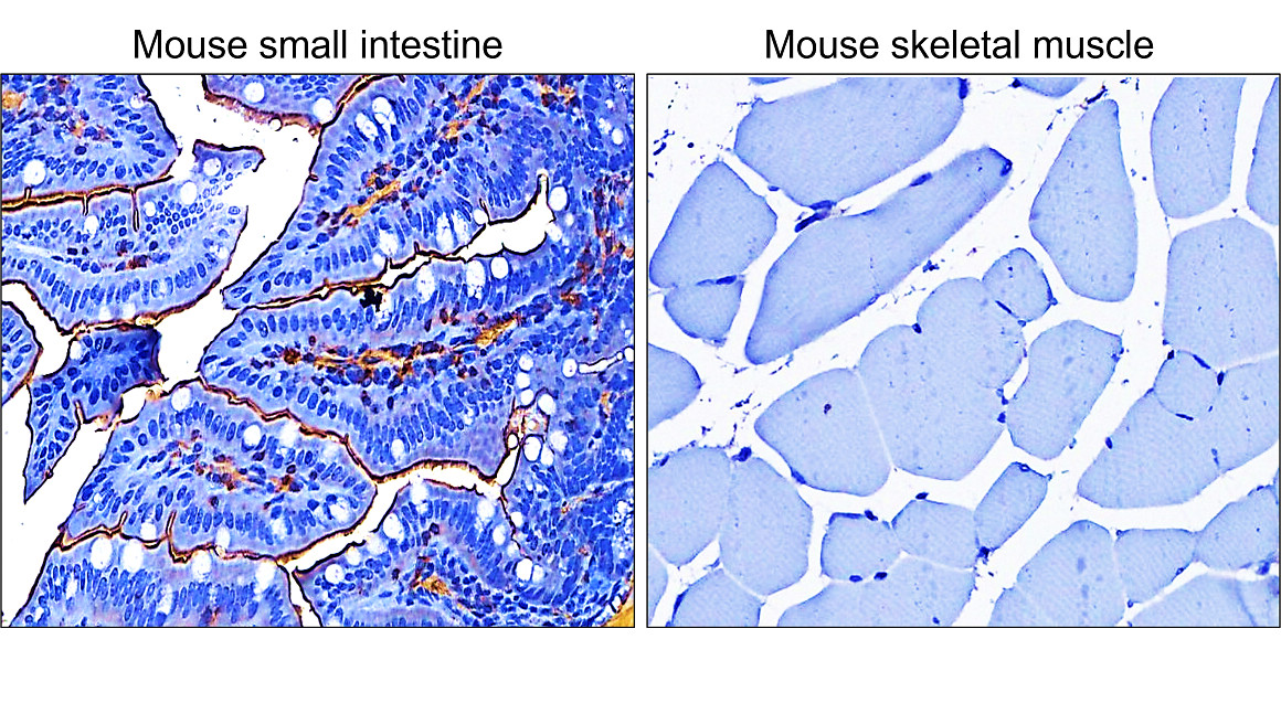 α-Smooth Muscle Actin Antibody