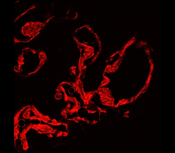 α-Smooth Muscle Actin