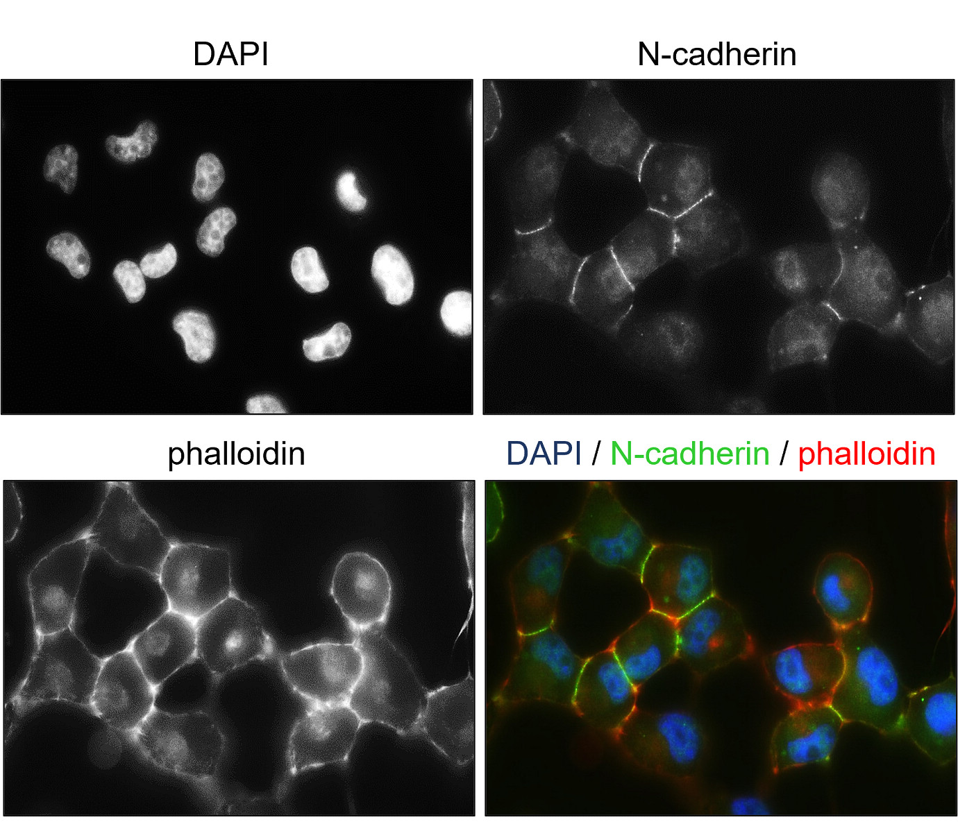 N-cadherin (Extracellular)