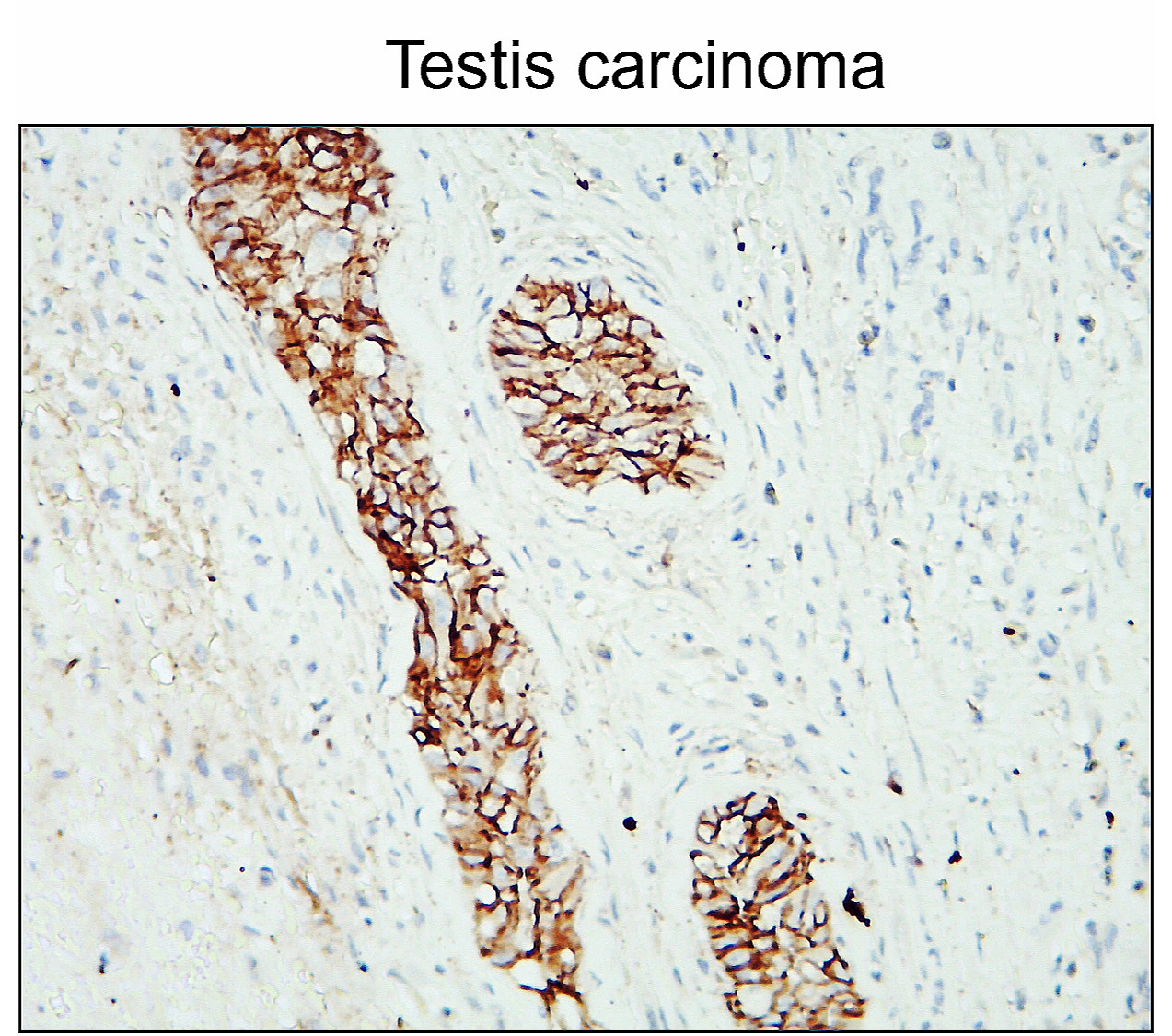 N-cadherin (Extracellular)
