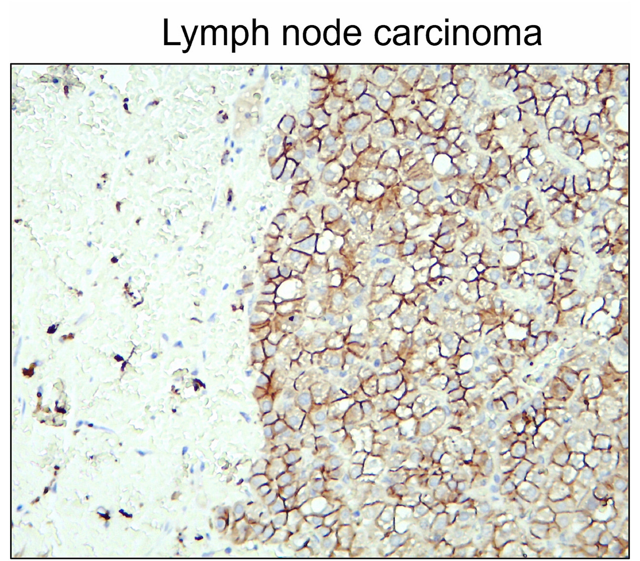 N-cadherin (Extracellular)