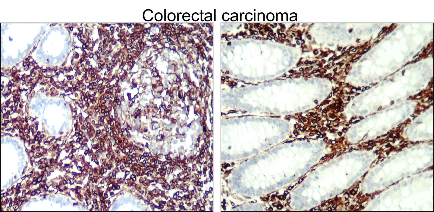 Vimentin Antibody