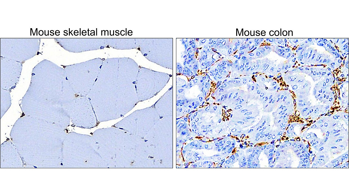 Vimentin Antibody