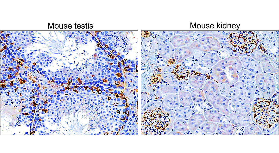 Vimentin Antibody