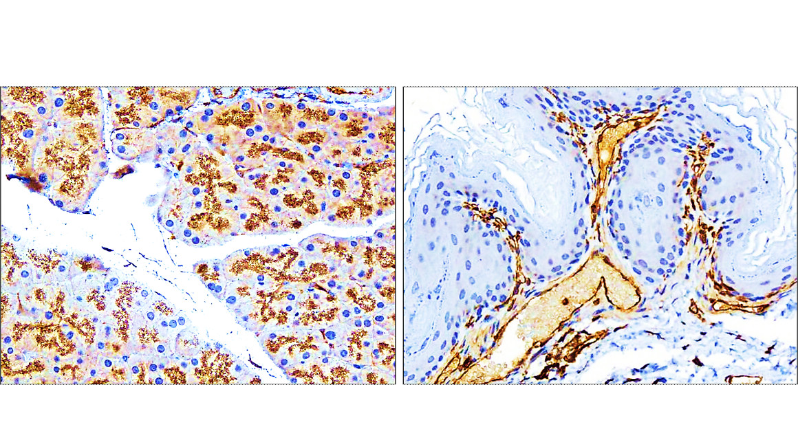 Vimentin Antibody