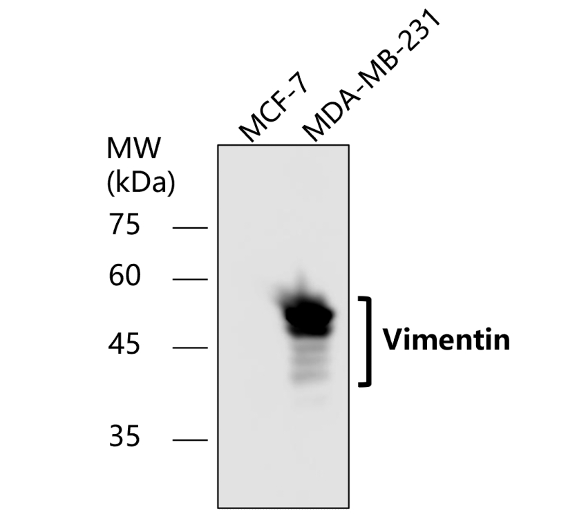 Vimentin Antibody