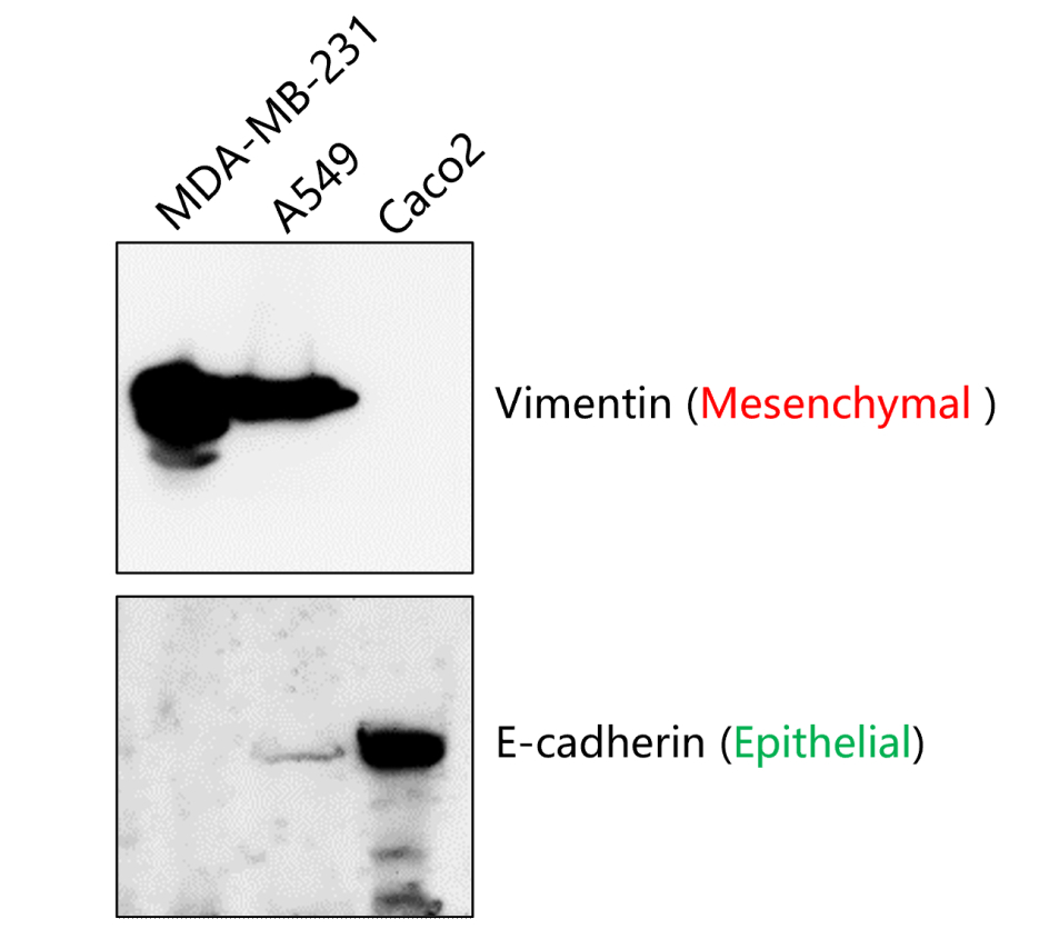 Vimentin Antibody