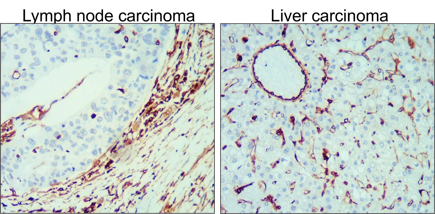 Vimentin Antibody