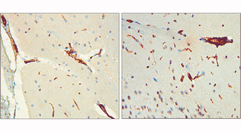 Tau (Phospho-Thr217) antibody