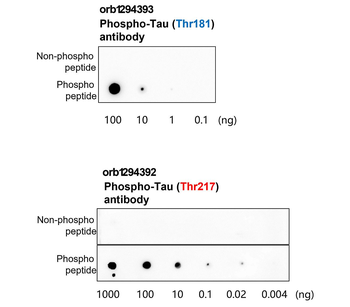 Tau (Phospho-Thr217) antibody