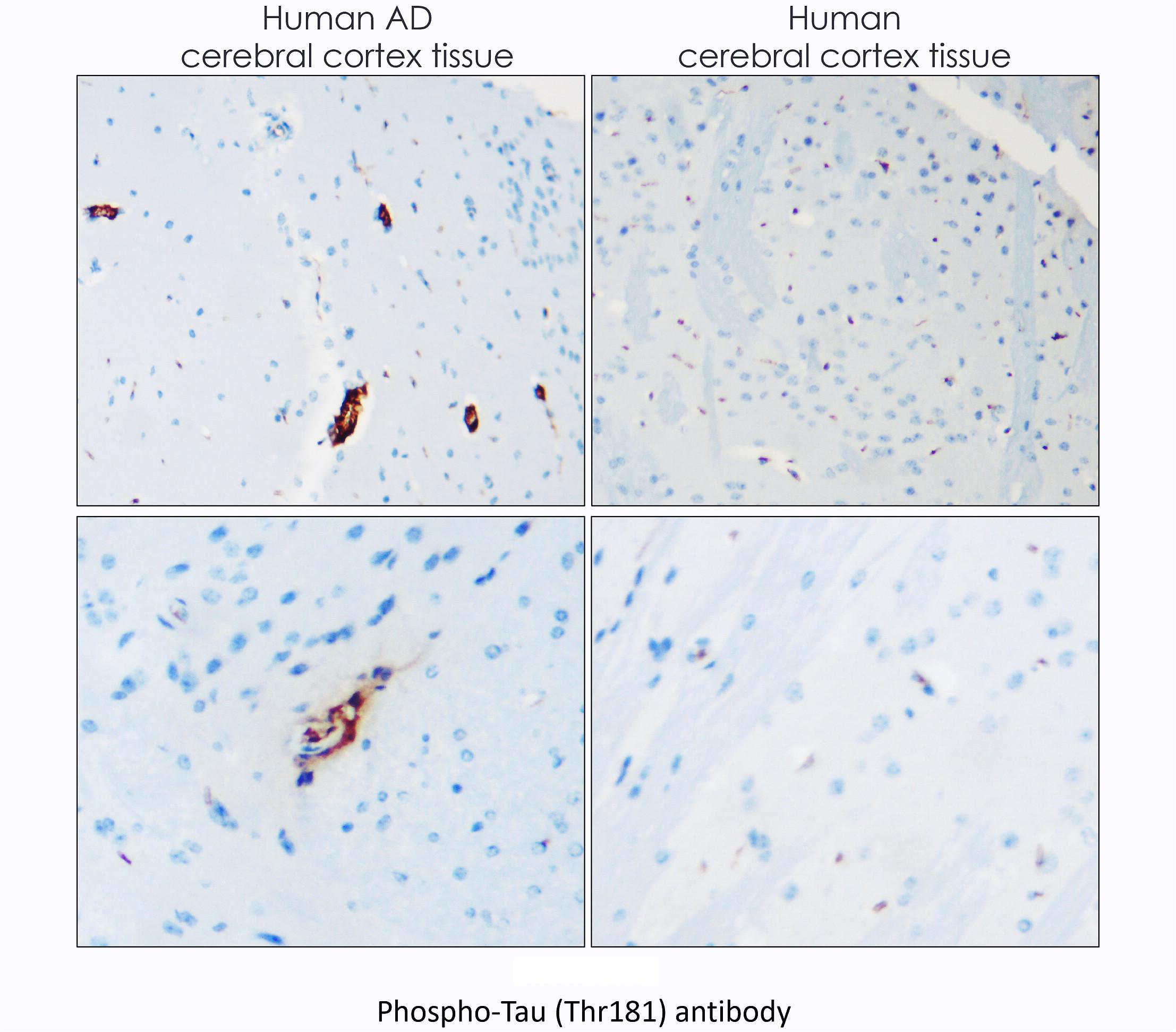 Tau (Phospho-Thr181) antibody