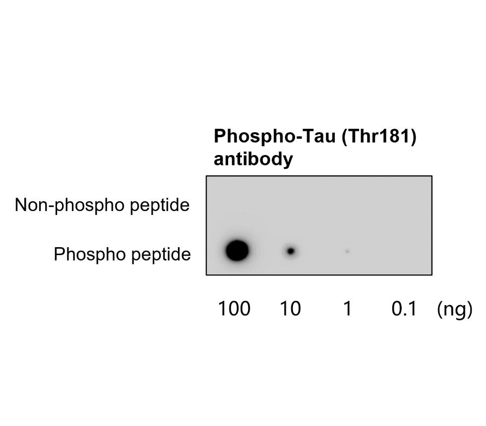 Tau (Phospho-Thr181) antibody