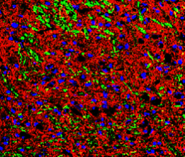 Tau (Phospho-Thr181) antibody