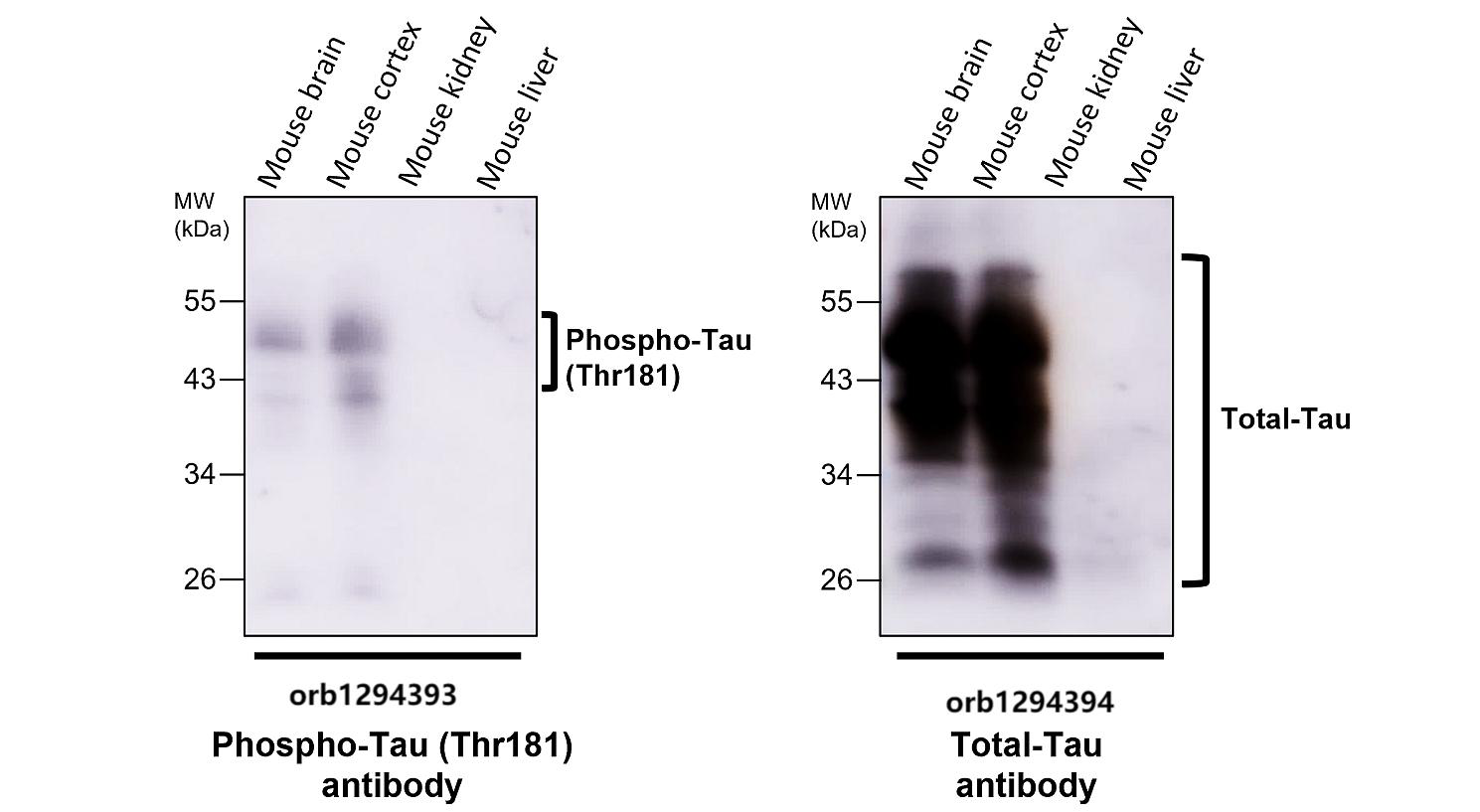 Tau (Phospho-Thr181) antibody