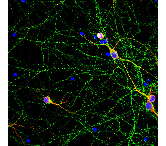 Tau (Phospho-Thr181) antibody