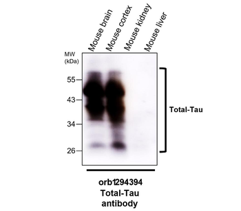 Tau Antibody