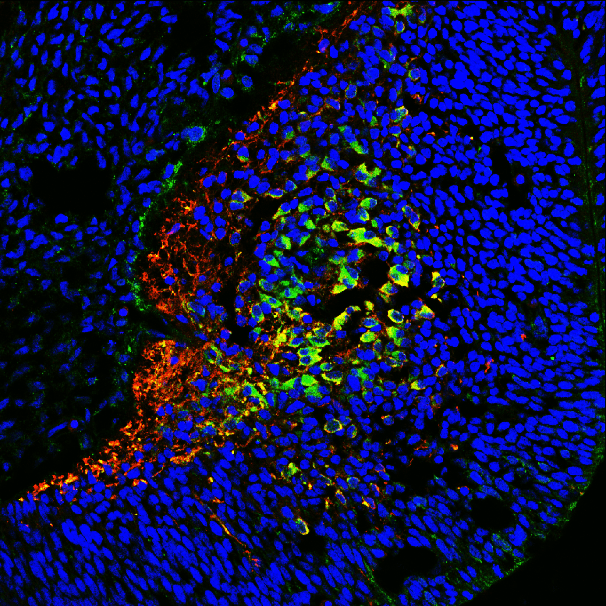 Tau Antibody